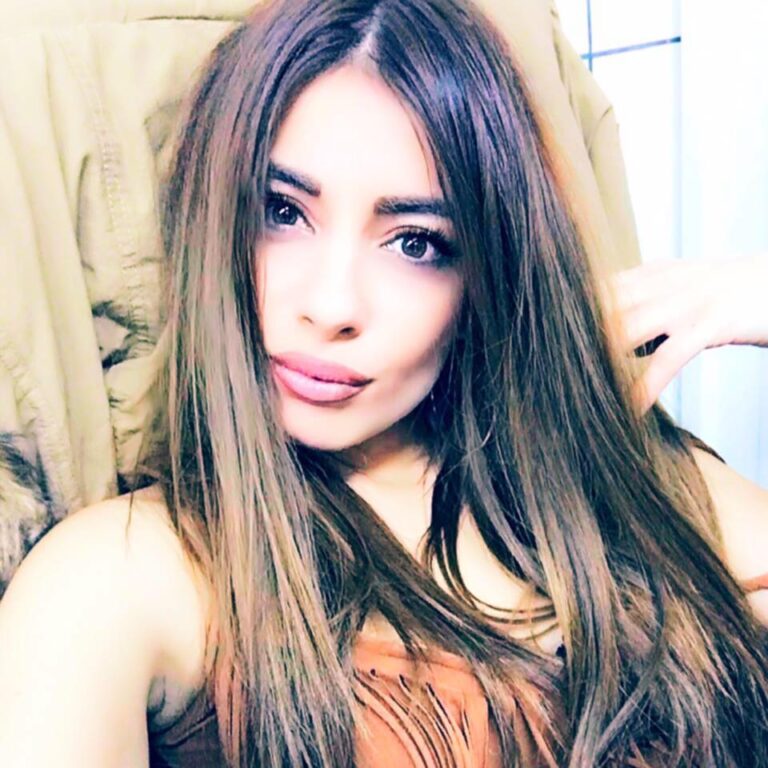 H Μίνα Αρναούτη αποκαλύπτει για πρώτη φορά τα σημάδια από το ατύχημα