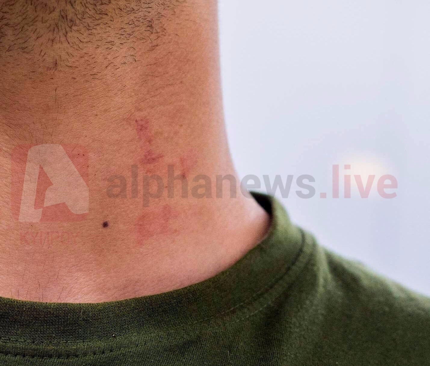 Σε διαθεσιμότητα ο αξιωματικός που καταγγέλθηκε για ξυλοδαρμό εθνοφρουρού