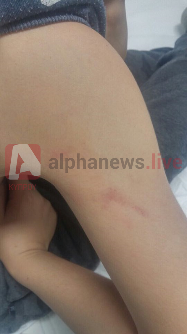 Λεμεσός: Υπό ανάκριση η δασκάλα που φέρεται να ξυλοκόπησε μαθητή της (ΦΩΤΟ)