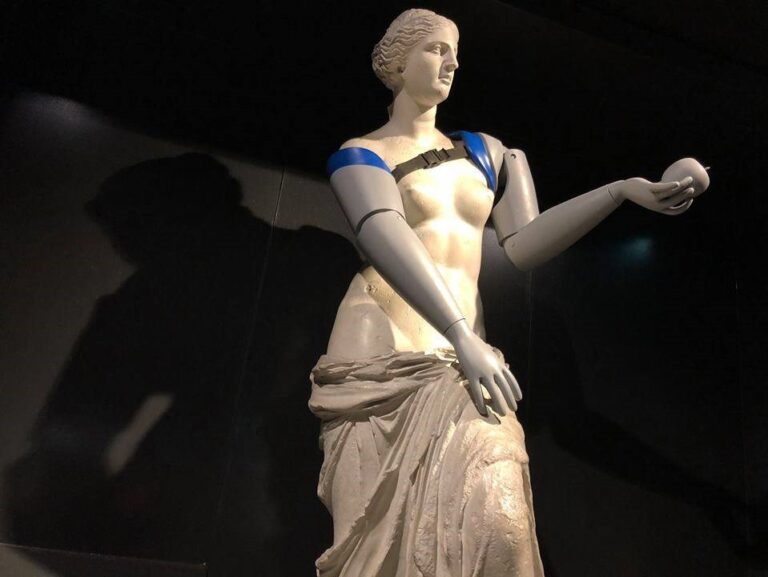 H "Aφροδίτη της Μήλου" με προσθετικά μέλη