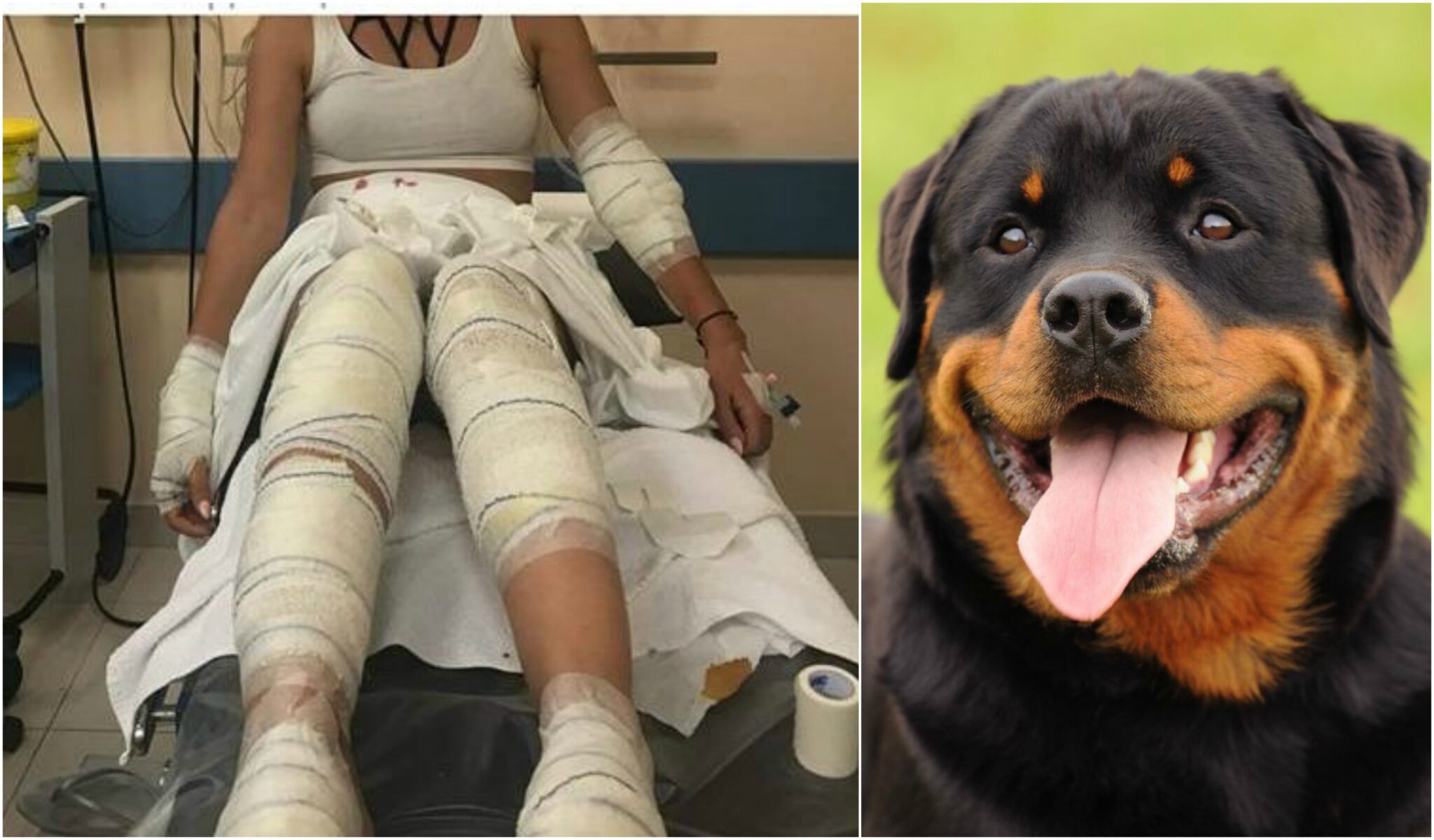 Καβγάς σκύλων με τραυματίες τους ιδιοκτήτες (ΒΙΝΤΕΟ)