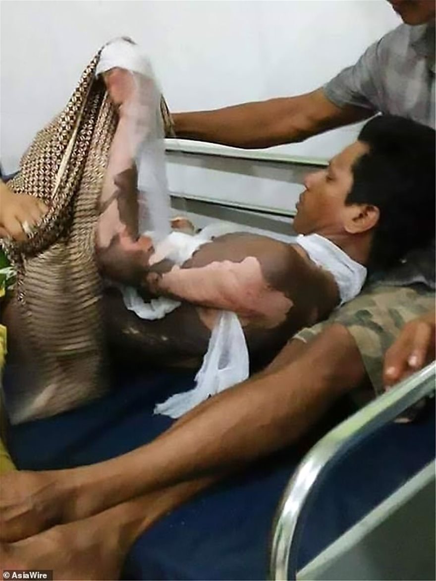 Έκαψε το σύζυγό της επειδή της έκρυψε τον κωδικό του κινητού του