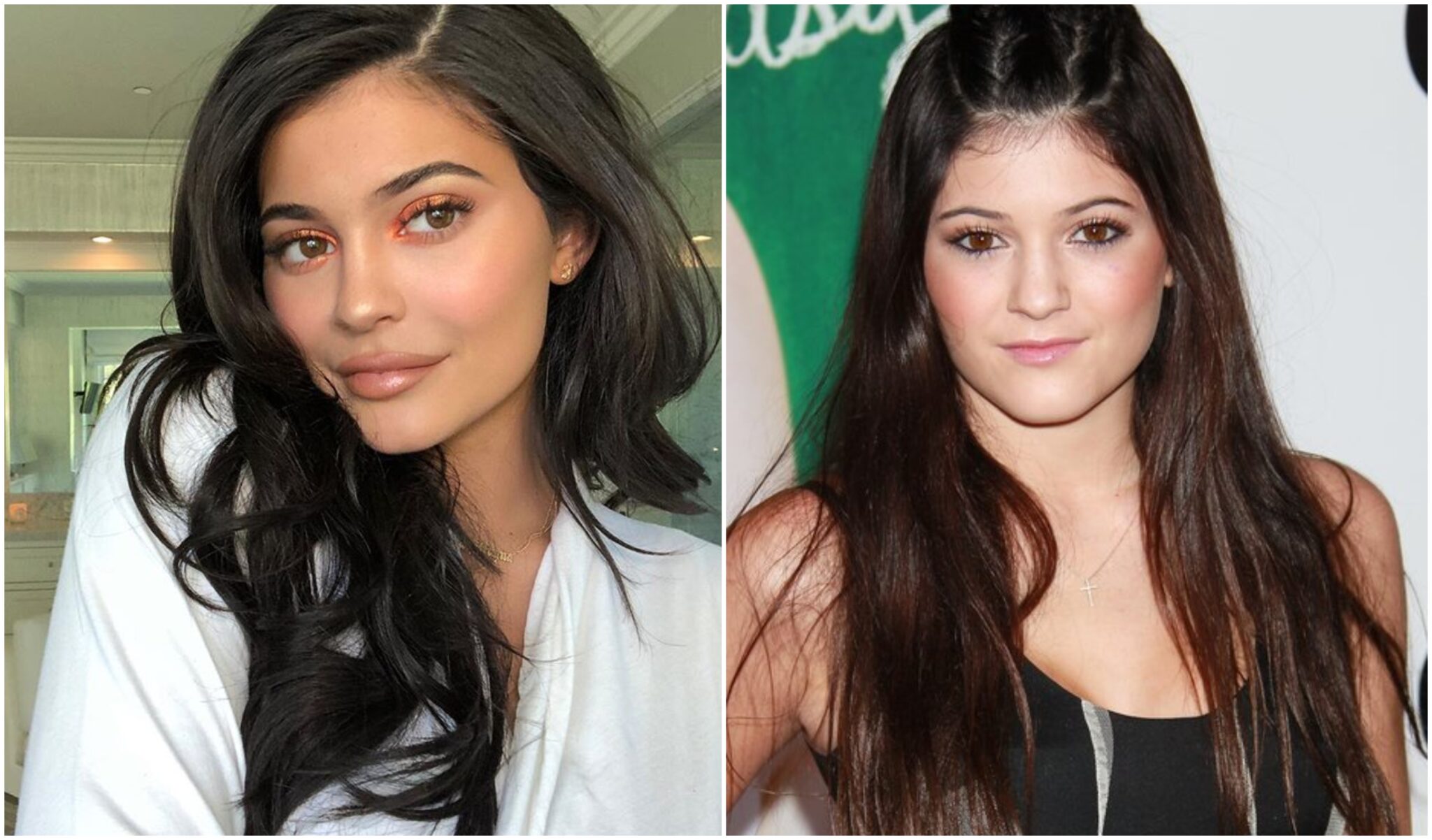 Η Κάιλι Τζένερ αρνείται ότι έχει κάνει… πλαστικές επεμβάσεις!