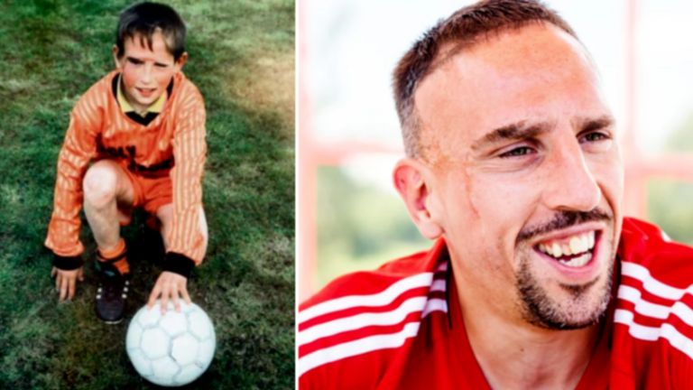 Ριμπερί: «Ο κόσμος με κοιτούσε για τα σημάδια, η οικογένειά μου υπέφερε» (ΦΩΤΟ)