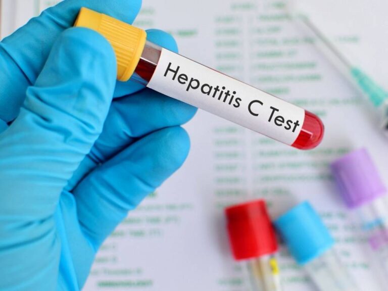 "Ναι" Υπουργικού στο Εθνικό Σχέδιο Δράσης για εκρίζωση της Ηπατίτιδας Γ’