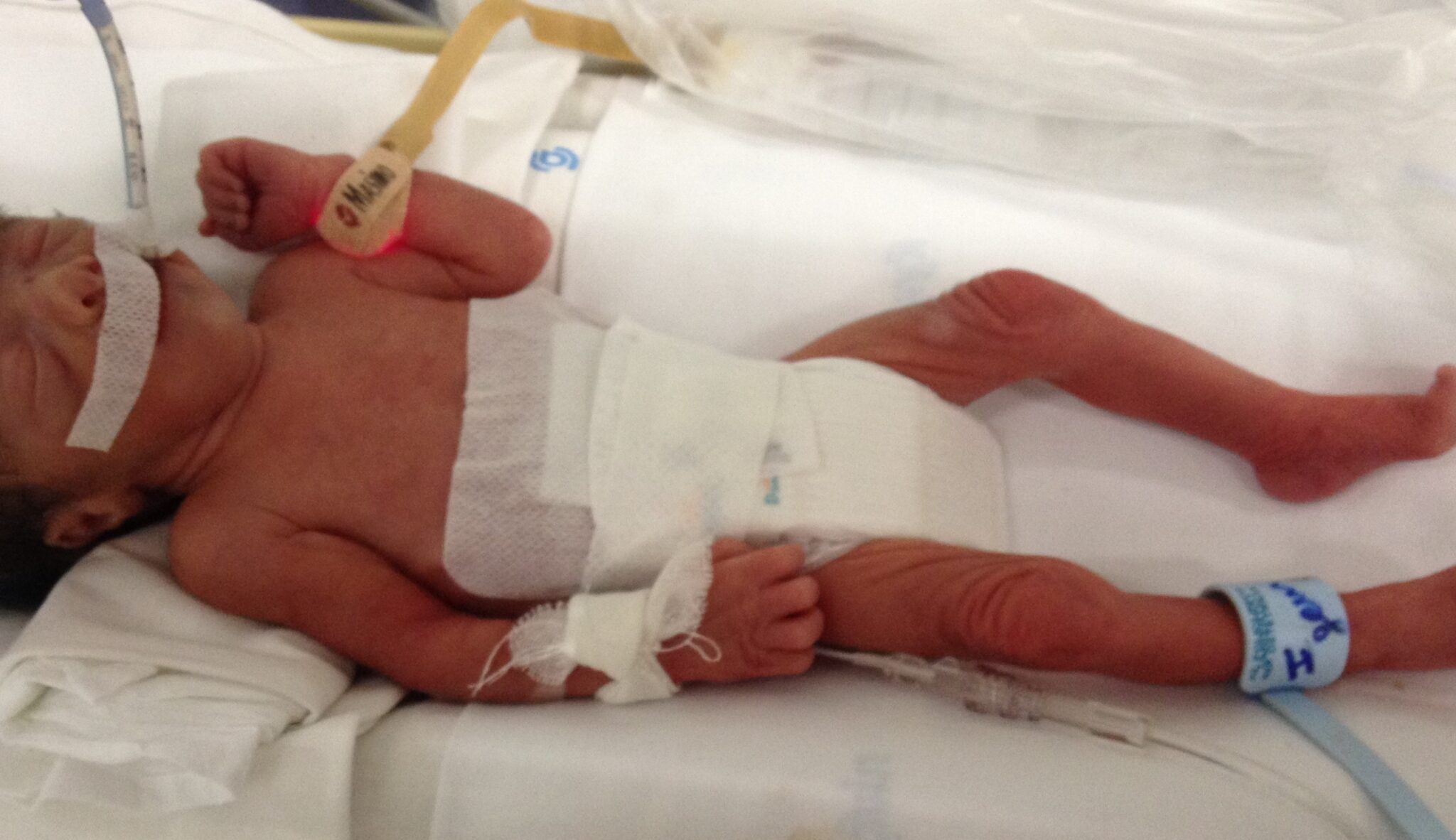 Συνεχίζονται οι έρευνες για τον τραυματισμό 13ημερών βρέφους