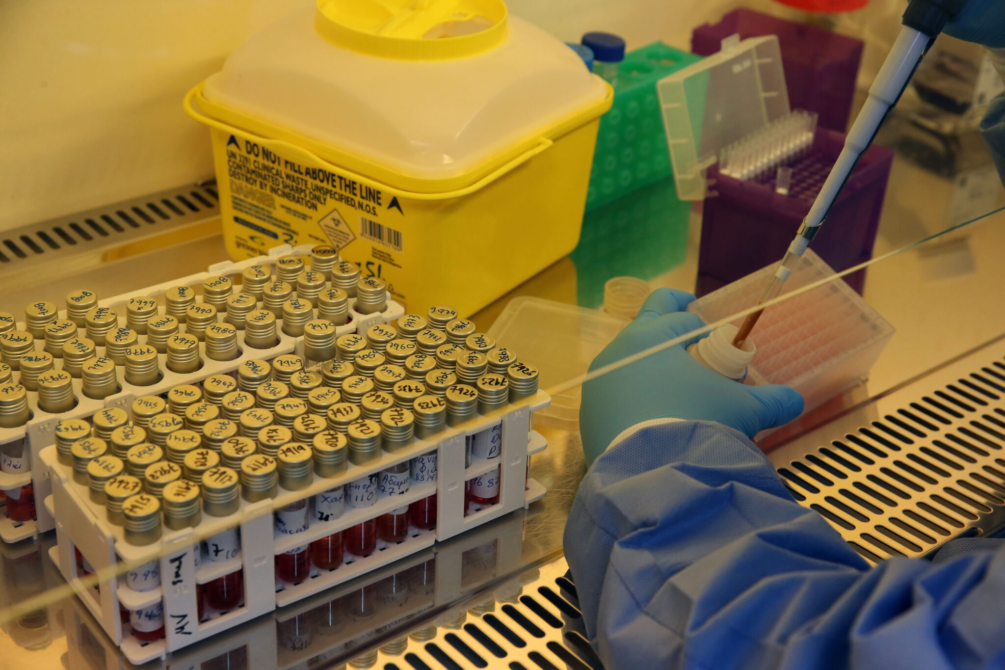 "Ισχυρές ενδείξεις" από την Ελεγκτική ότι η τιμή για τεστ κορωνοϊού είναι υψηλή