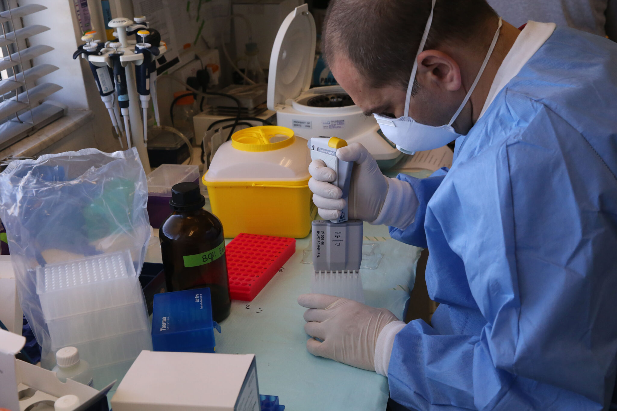 Ποια σενάρια εξετάζονται για τη σύνδεση της νόσου καβασάκι με την covid (ΒΙΝΤΕΟ)