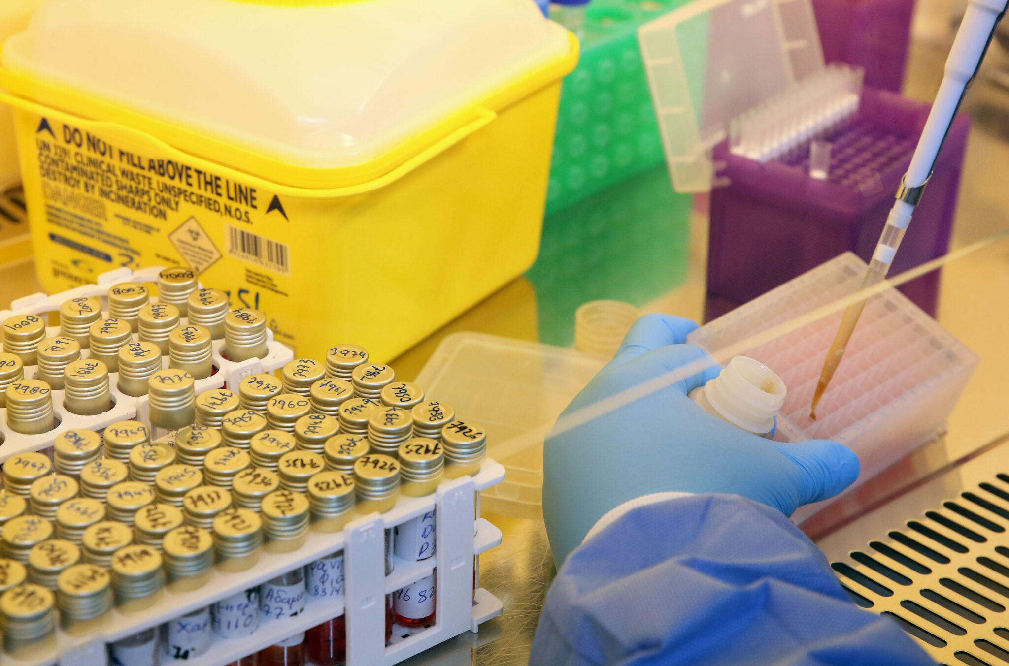 Δύο νέα κρούσματα κορωνοϊου σύμφωνα με νεότερη ανακοίνωση