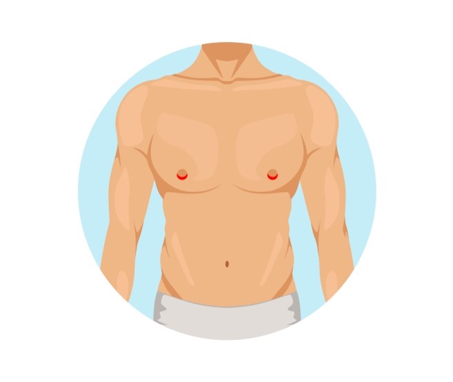 Γυναικομαστία