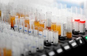 Αδειοδότηση για 'υπό όρους κυκλοφορία' του remdesivir εντός ΕΕ εισηγείται η ΕΜΑ