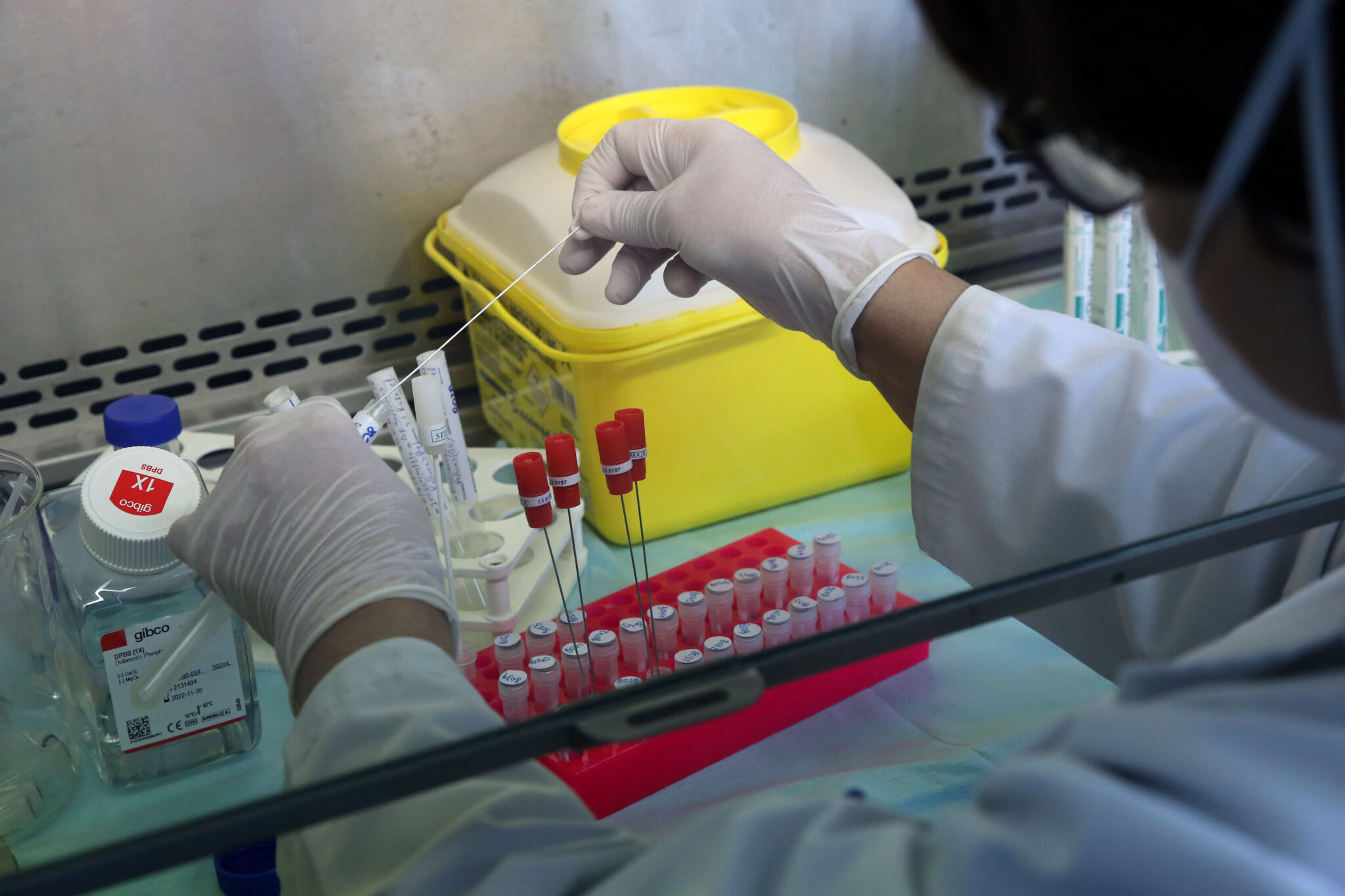 Έξι νέα κρούσματα, τα πέντε εντοπίστηκαν στη Λεμεσό