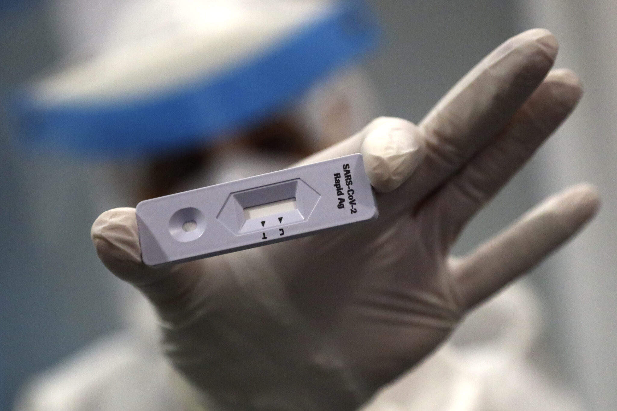 Εγκρίθηκε το πρώτο τεστ αυτοελέγχου για κορωνοϊό από την FDA