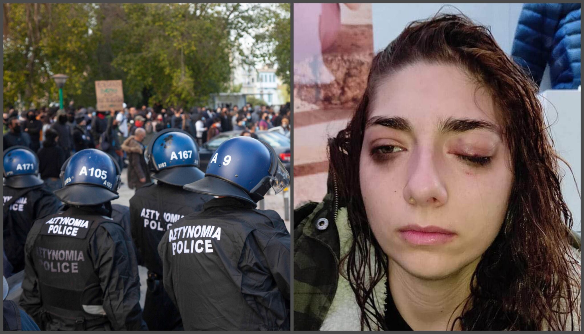 "Αγχωμένη και στεναχωρημένη η Αναστασία" που υποβλήθηκε σε χειρουργική επέμβαση