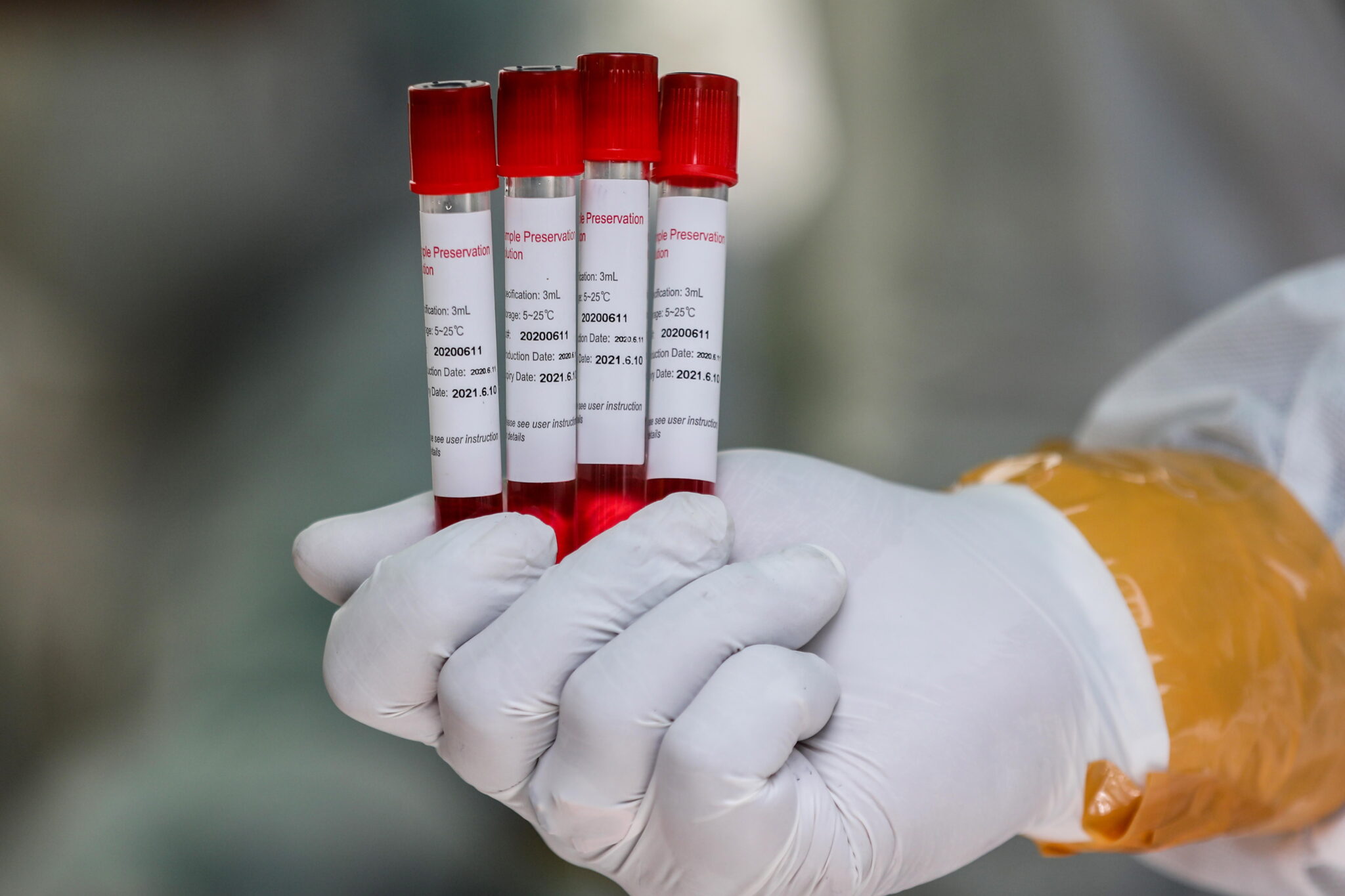 Άλλο ένα κρούσμα κορωνοϊού στο χώρο του αθλητισμού