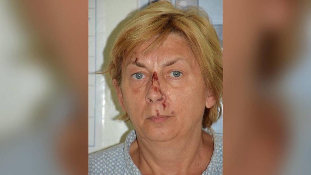 «Μιλάει αγγλικά αλλά δεν θυμάται ποια είναι»