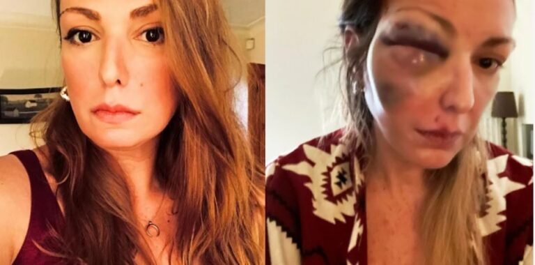 Σοκάρει η Στεφανία: Αποκαλύπτει την κακοποίησή της από το σύντροφό της (ΦΩΤΟ)