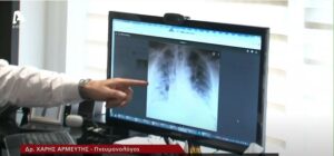 Τι πρέπει να προσέξουν τα κρούσματα κορωνοϊού μετά την αρνητικοποίησή τους;