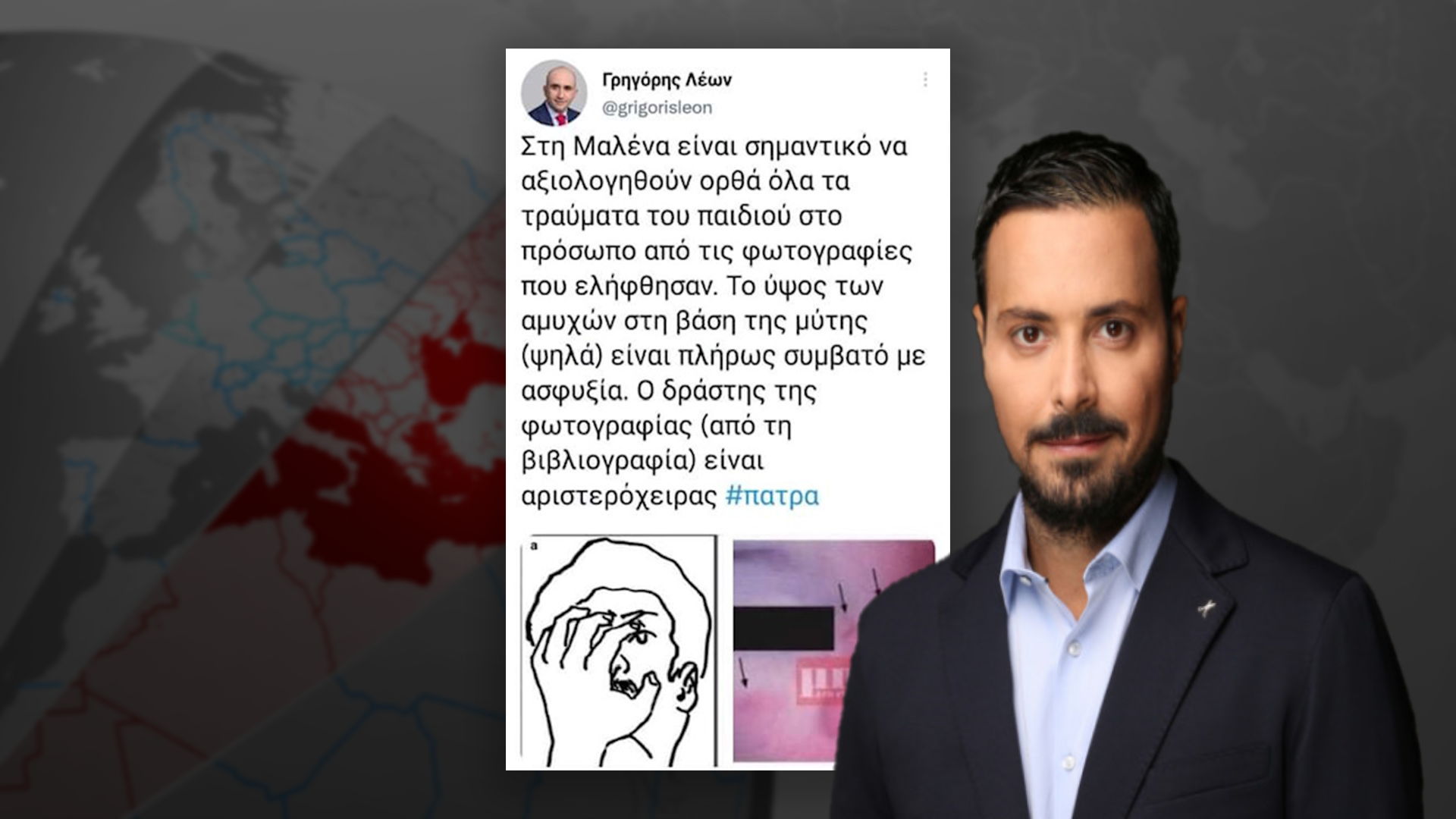 "Μια εικόνα χίλιες λέξεις" λέει ο Κουσουλός για τη σοκαριστική ανάρτηση του Λέων