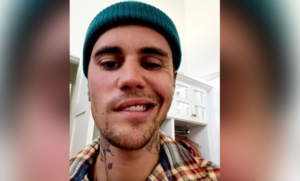 Bieber: Αυτή είναι η κατάσταση της υγείας του μετά την παράλυση του προσώπου του