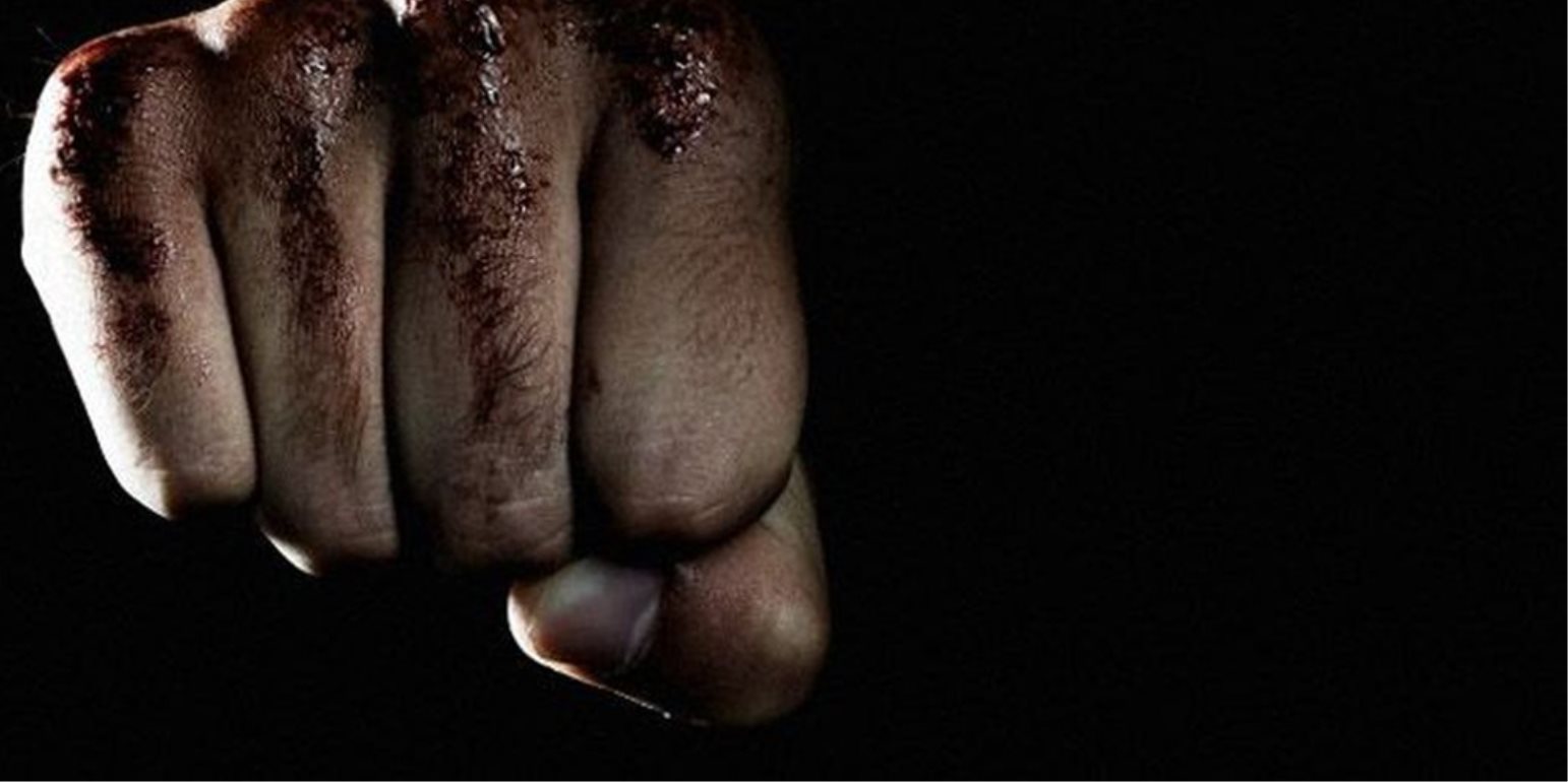 Μάχη για να κρατηθεί στη ζωή δίνει 47χρονος, ξυλοκοπήθηκε σε συναυλία