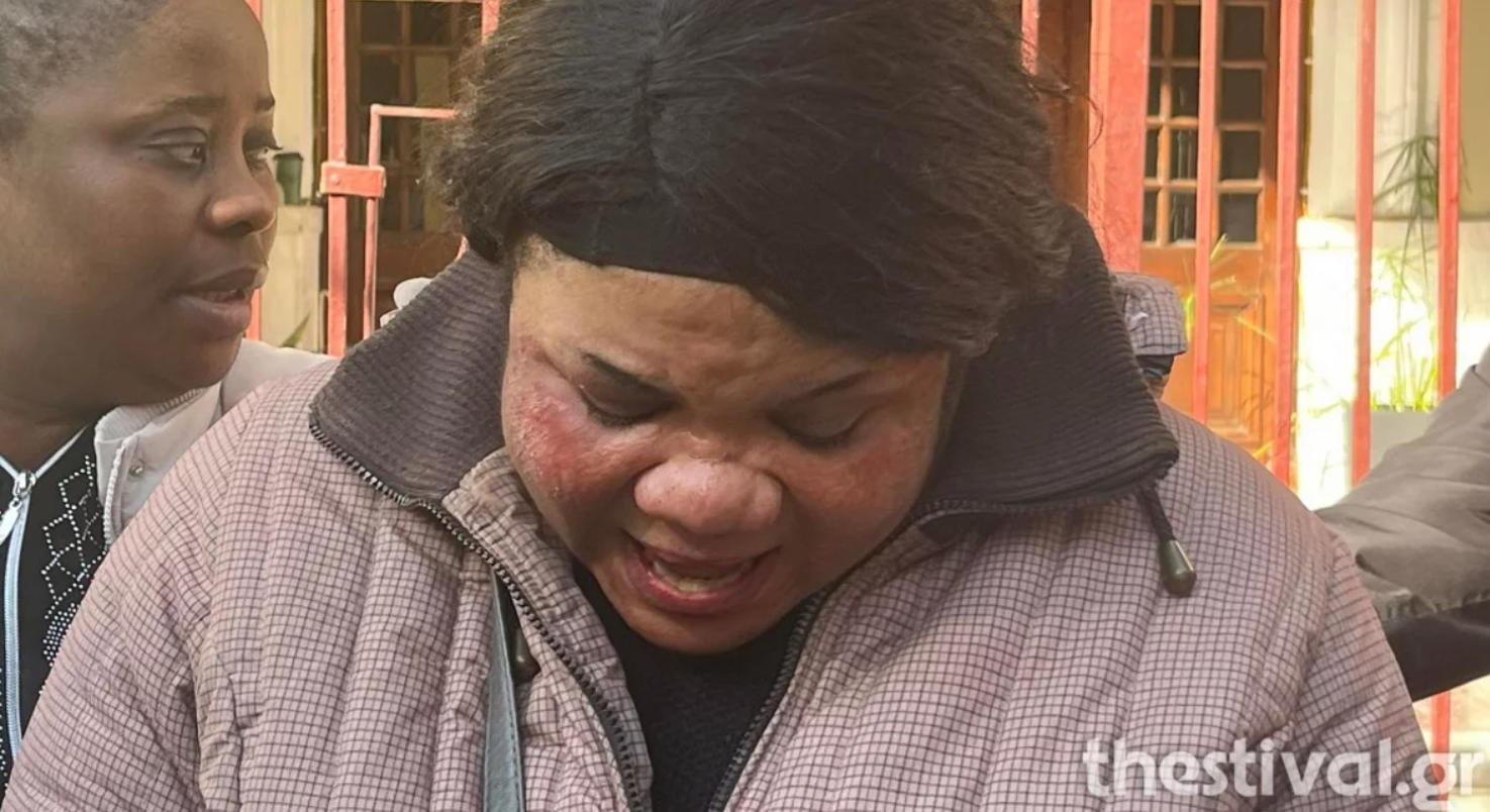 Σε σοκ η μητέρα του κοριτσιού: «Την άφησαν να πεθάνει γιατί ήταν μαύρη»