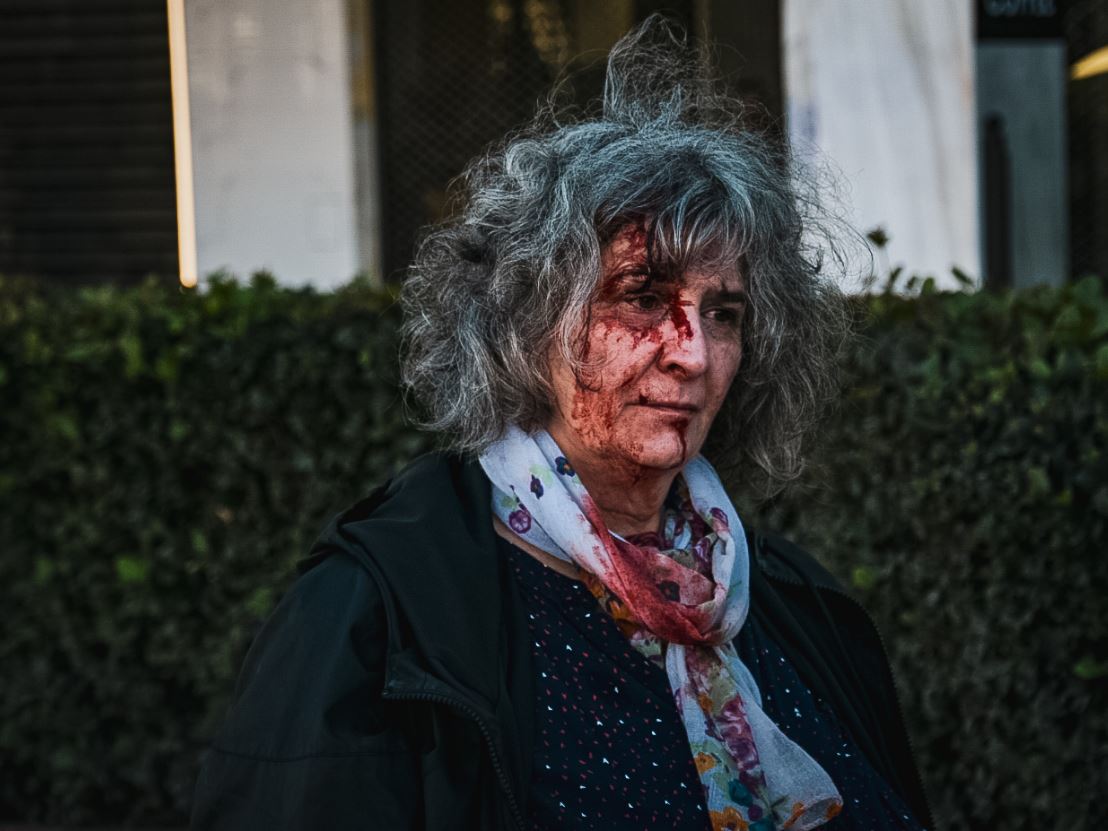 Διαψεύδει τον τραυματισμό της γυναίκας στην πορεία στο Σύνταγμα η ΕΛ.ΑΣ