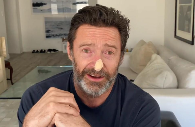 Χιου Τζάκμαν: Μοιράστηκε τα αποτελέσματα των βιοψιών του καρκίνου του δέρματος