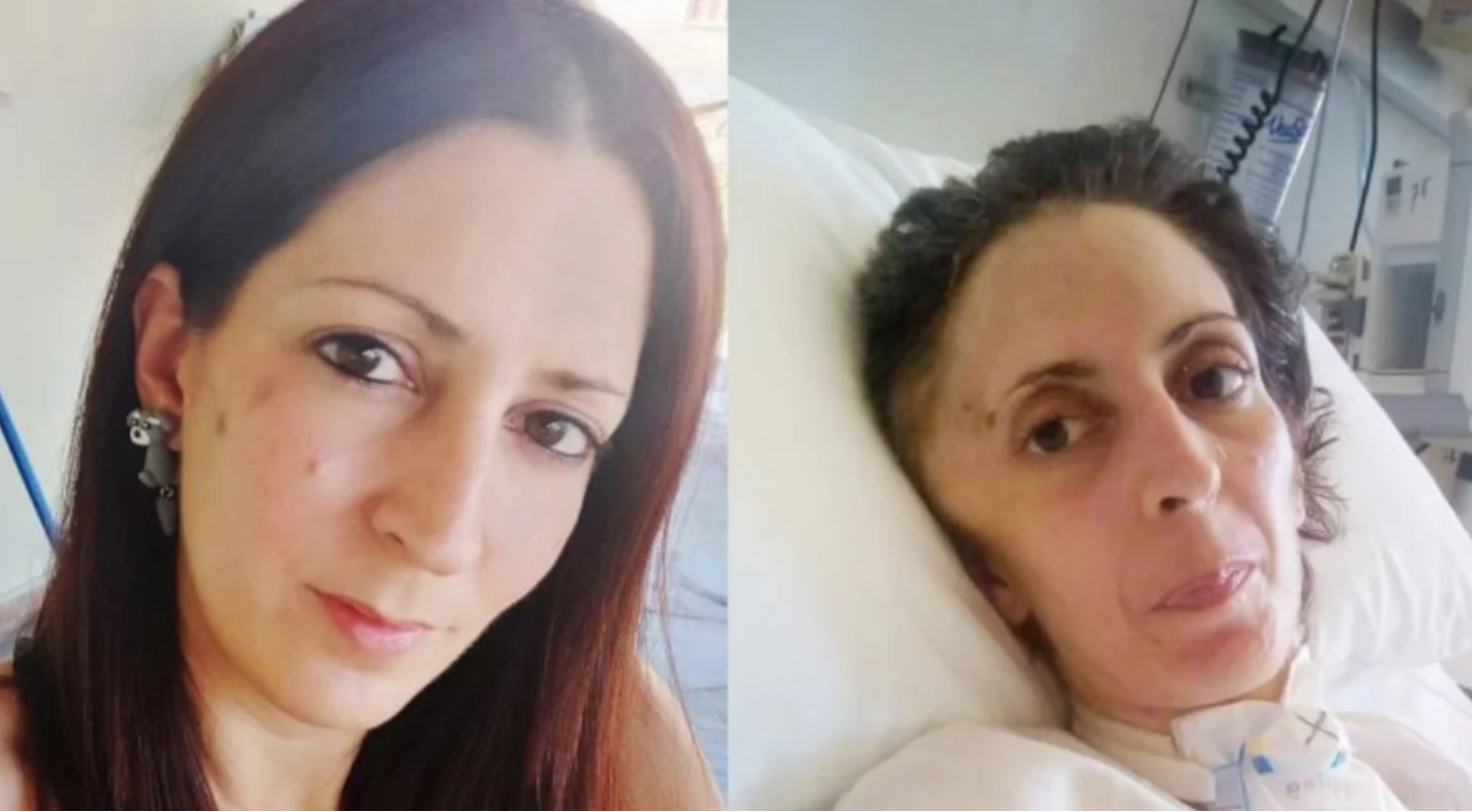 Πέθανε η 41χρονη Όλγα που ξυλοκοπήθηκε από τον «τζουντόκα» πρώην σύντροφό της