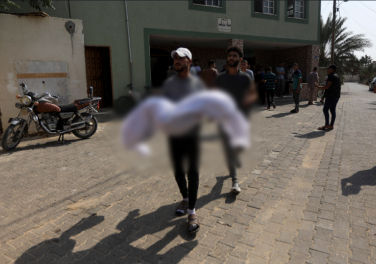 Συγκλονίζει γιατρός στη Γάζα: «Όπου κι αν πας, βλέπεις θάνατο»