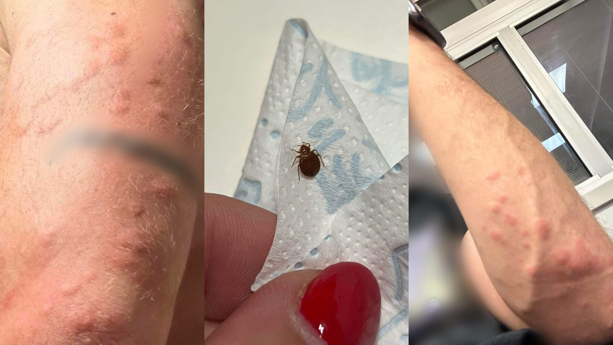 ΦΩΤΟ: Με κοριούς…επέστρεψε από ταξίδι στην Ελλάδα οικογένεια Κυπρίων