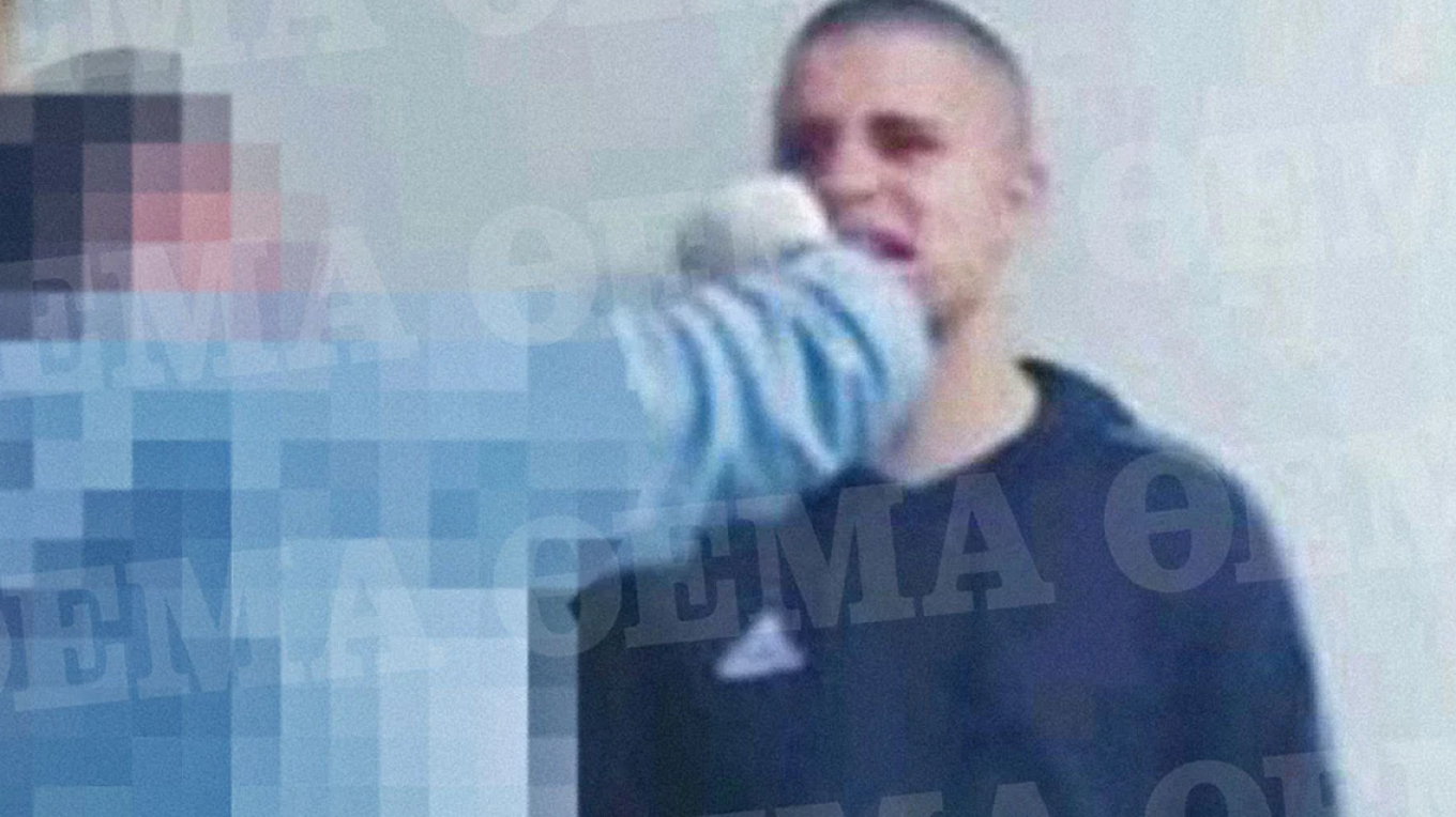 Ρέντη: Στον εισαγγελέα σήμερα ο 18χρονος που ομολόγησε ότι έριξε τη φωτοβολίδα