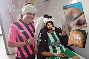 Σοβαρός τραυματισμός ποδοσφαιριστριών