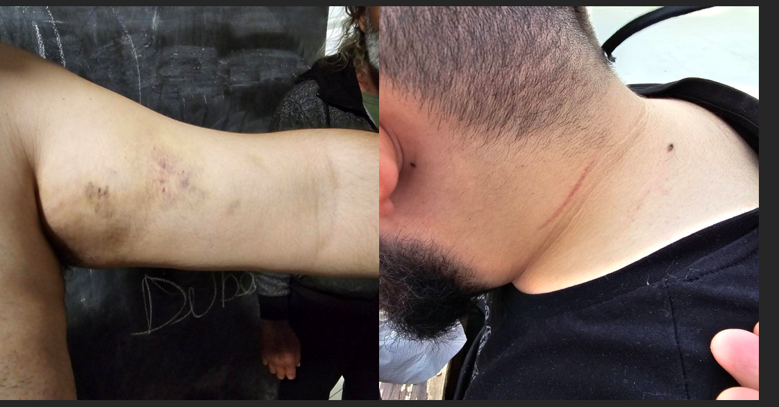 Καταγγελία μάνας: «Ο γιός μου ξυλοκοπήθηκε από νοσηλευτές Ψυχιατρείου Αθαλάσσας»