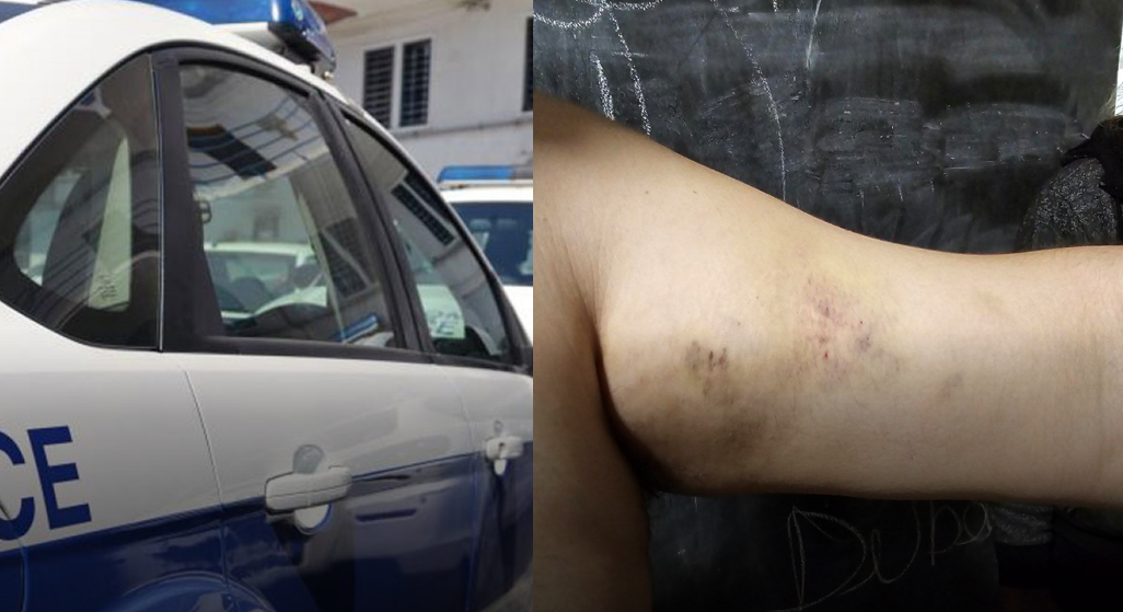 Σε εξέλιξη οι έρευνες μετά την καταγγελία για ξυλοδαρμό ασθενούς στο ψυχιατρείο