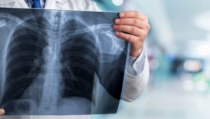 «Έμεινε» από ακτινολόγους το ΓΝ Πάφου, στα όριά τους οι γιατροί