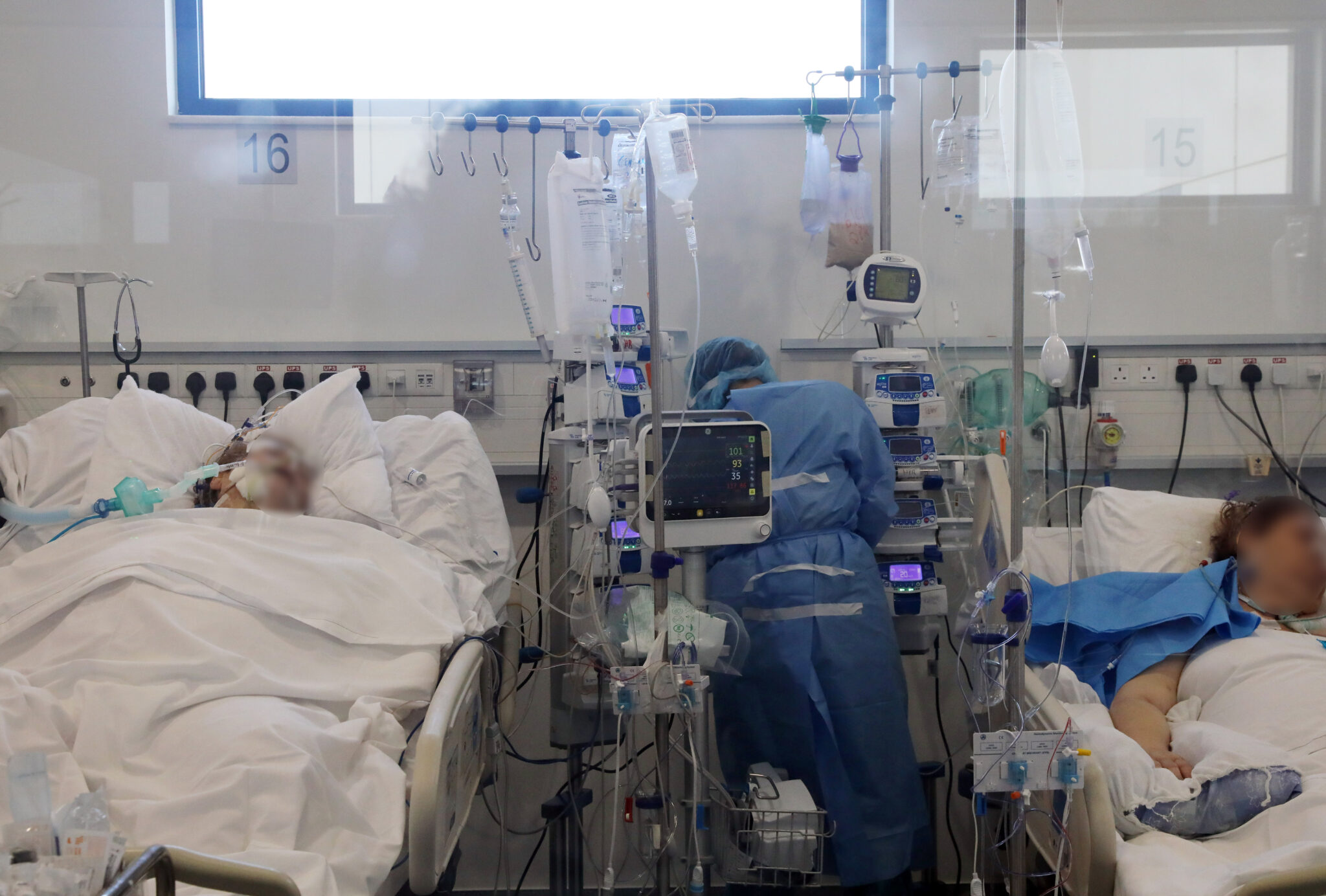 Στην εντατική ο 56χρονος που επιχείρησε βουτιά σε πισίνα και κατέληξε στο έδαφος