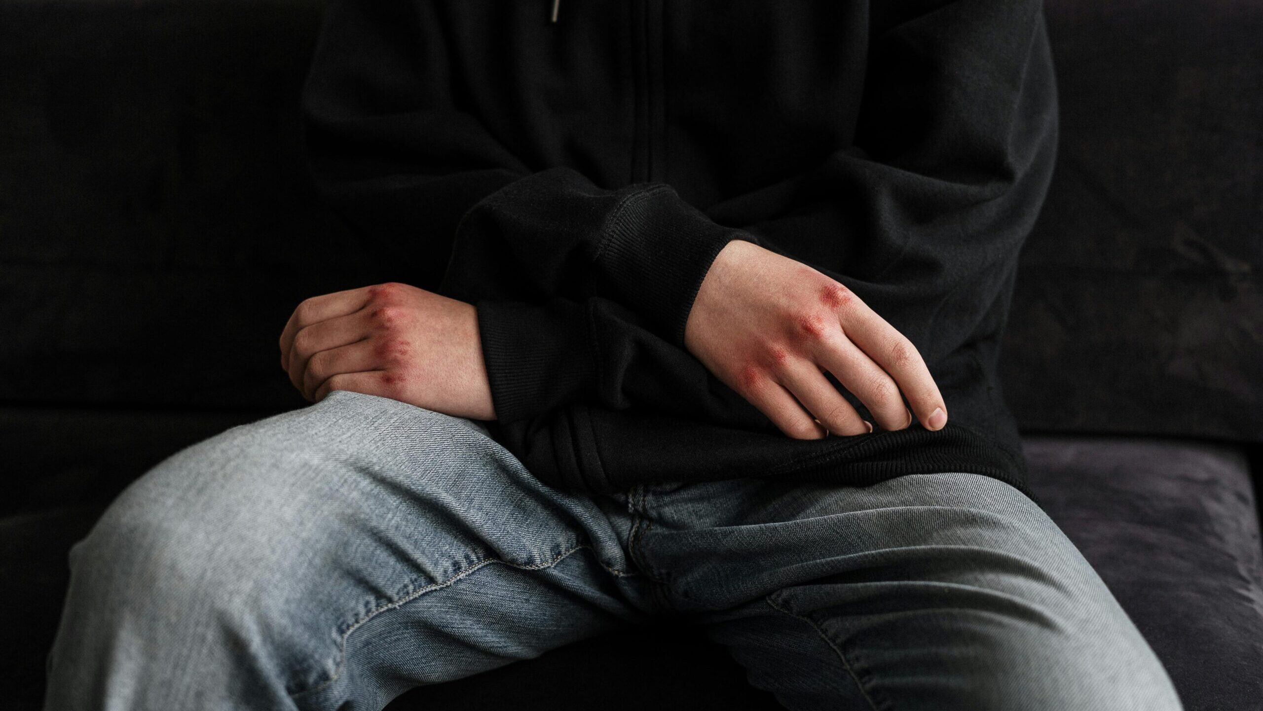 «Πήγα να τον πάρω και δεν τον κατάλαβα»: Μητέρα καταγγέλλει άγριο ξυλοδαρμό του 15χρονου γιου της σε σχολείο «Πήγα να τον πάρω και δεν τον κατάλαβα»: Μητέρα καταγγέλλει άγριο ξυλοδαρμό του 15χρονου γιου της σε σχολείο