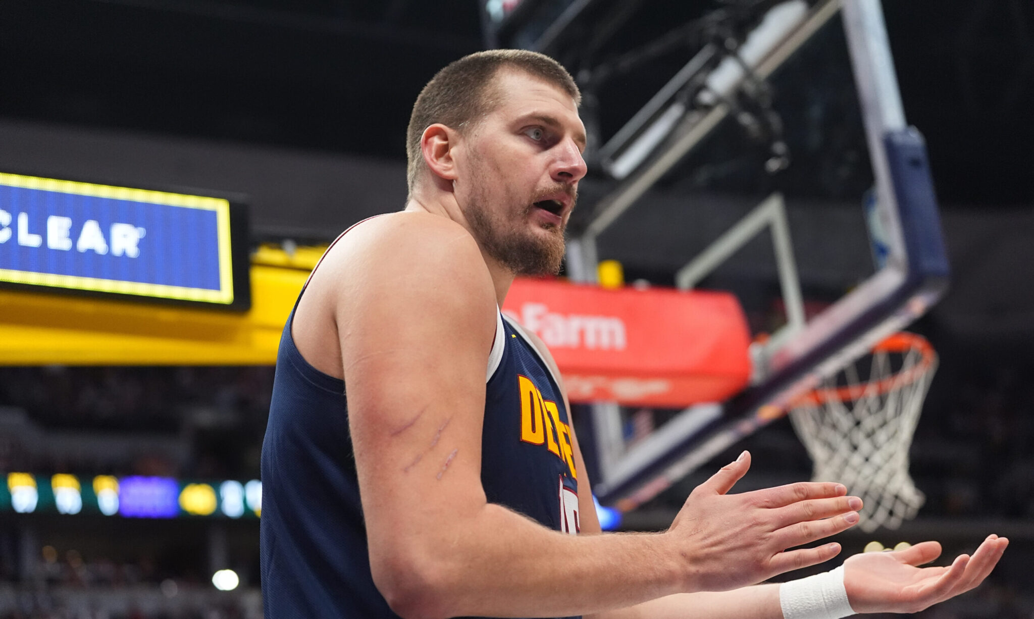 Η πρώτη εκτίμηση για τον τραυματισμό του Γιόκιτς