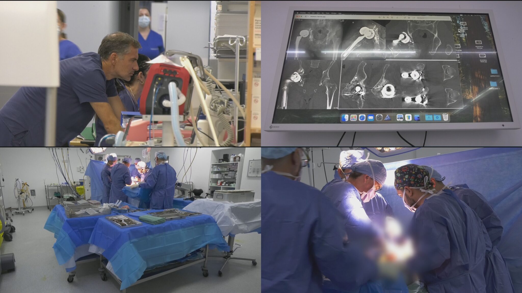 ΒΙΝΤΕΟ: Πώς χειρουργική επέμβαση έλυσε το σοβαρό πρόβλημα 46χρονου που δεν μπορούσε να περπατήσει