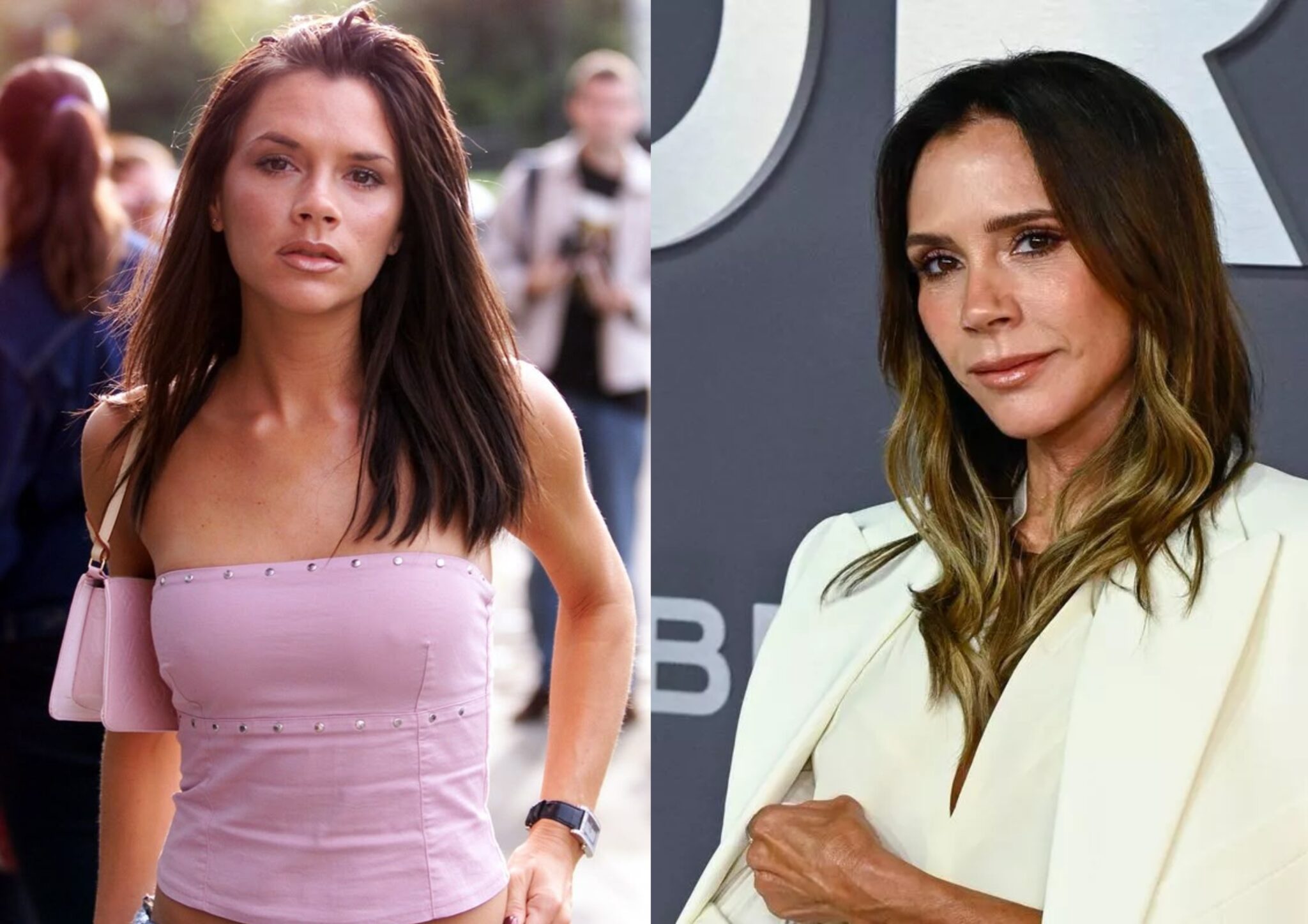 Βικτόρια Μπέκαμ: Τι έχει αλλάξει πάνω της – Όλη η αλήθεια για τις αισθητικές επεμβάσεις