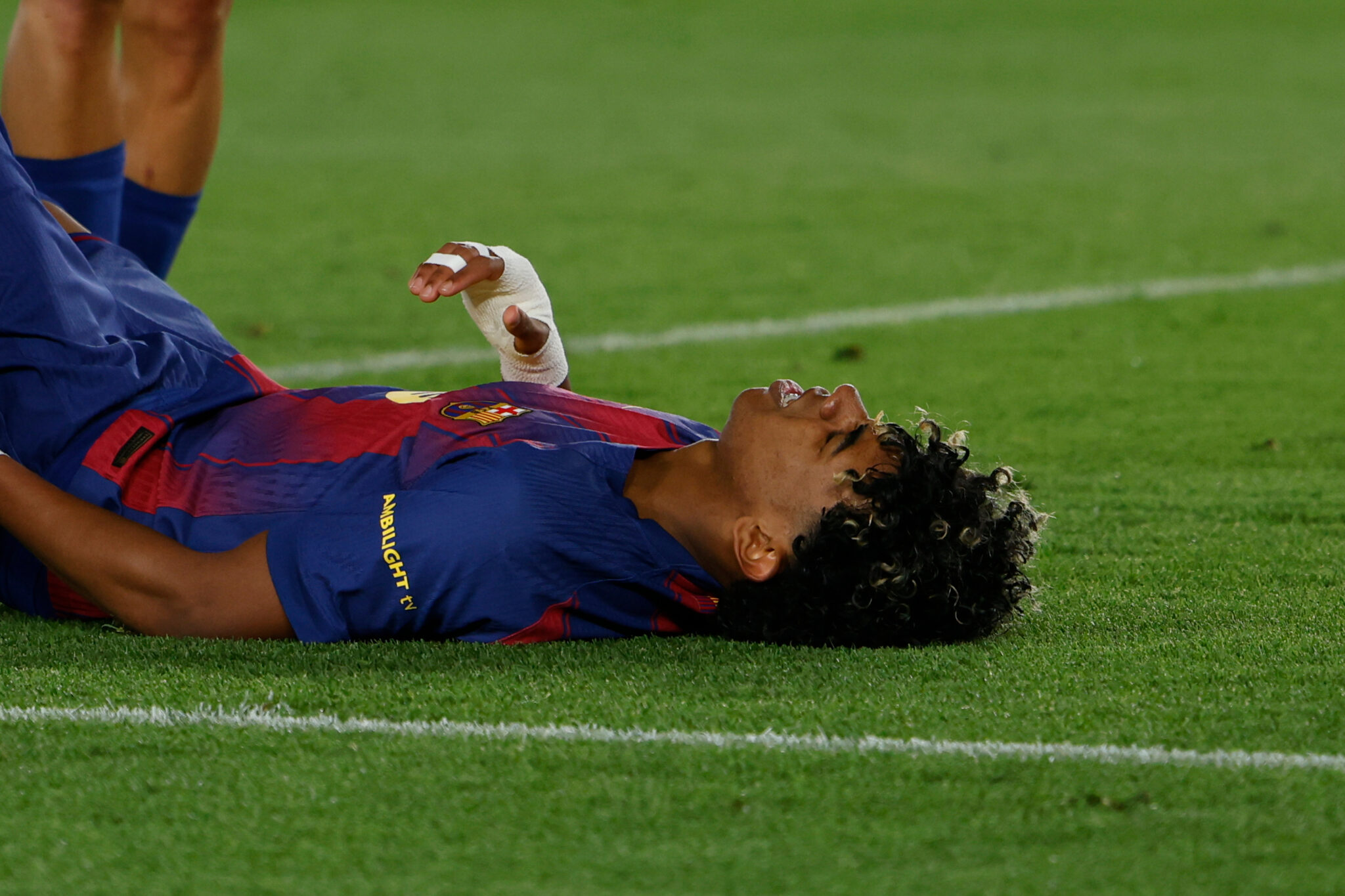 Ανησυχία σε Μπαρσελόνα και Ισπανία για Γιαμάλ: Έβαλε πέναλτι, τραυματίστηκε στην εκτέλεση και πήγε στα αποδυτήρια