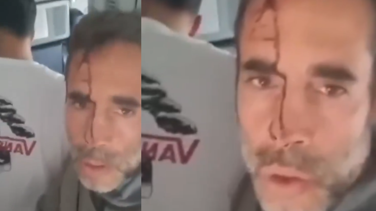 «Μόλις εξουδετερώσαμε τον αεροπειρατή! Προσπάθησε να ρίξει το αεροπλάνο»: Σοκαριστικό βίντεο με επιβάτη μέσα από την πτήση προς Τελ Αβίβ